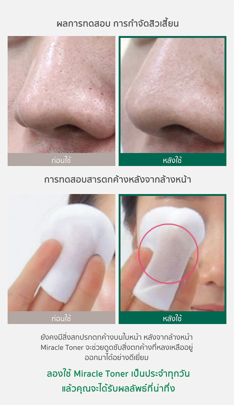 some by mi รีวิว,some by mi serum รีวิว,some by mi toner รีวิว,some by mi miracle toner ราคา,some by mi miracle toner รีวิว,some by mi miracle serum รีวิว,some by mi miracle toner review,some by mi โทนเนอร์